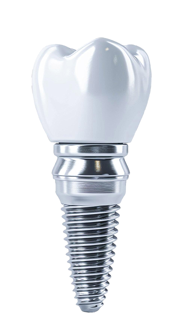 Successful Dental Treatment